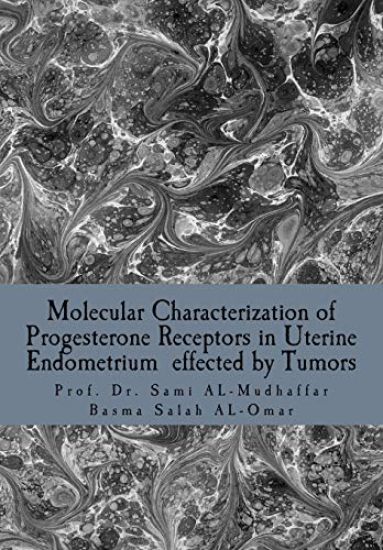 Molecular Characterization of Progesterone Receptors in Uterine Endometrium effected by Tumors: Progesterone in Uterine Tumors