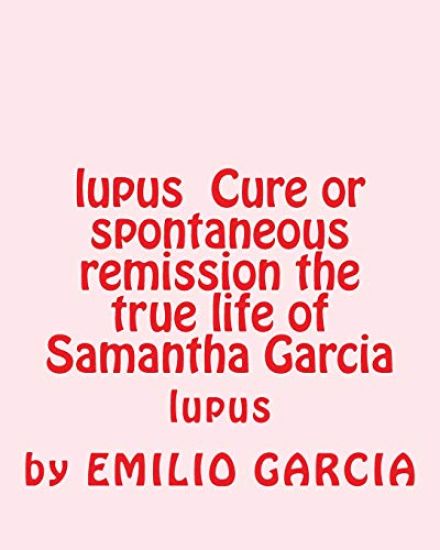 lupus Cure or spontaneous remission the true life of Samantha Garcia: lupus