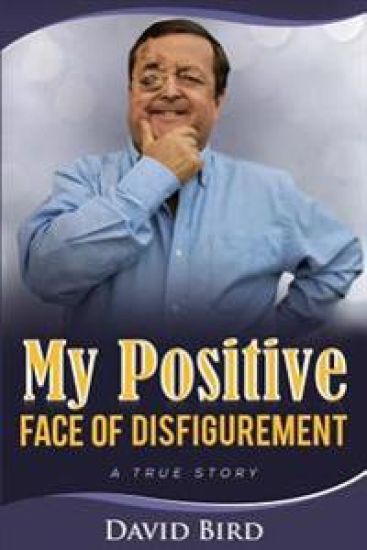 My Positive Face Of Disfigurement: A True Story