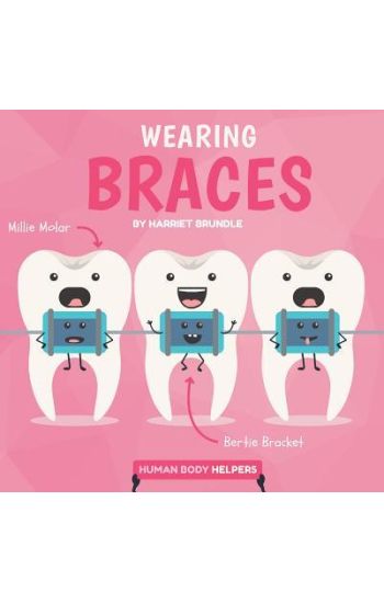 Wearing Braces