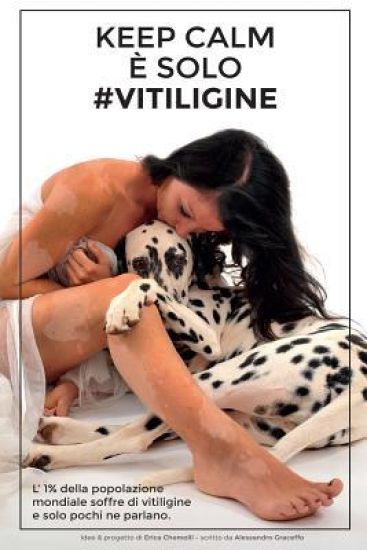 Keep Calm È Solo #Vitiligine