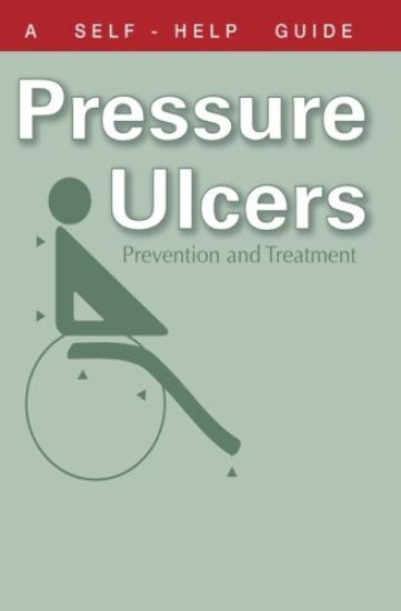 The Doctor's Guide to Pressure Ulcers: Prevention and Treatment