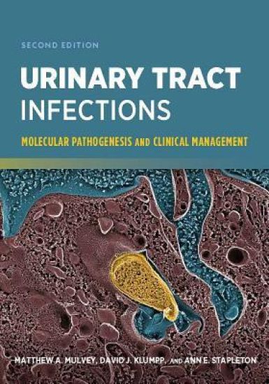 Urinary Tract Infections