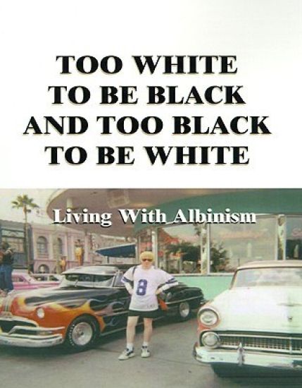 Too White to be Black and Too Black to be White