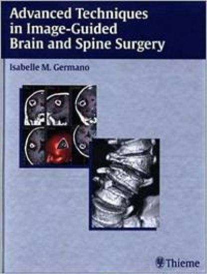 Advanced Techniques in Image-Guided Brain and Spine Surgery