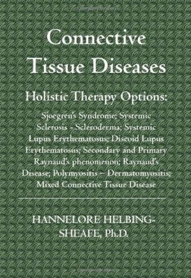 Connective Tissue Diseases: Holistic Therapy Options: Sjoegren's Syndrome; Systemic Sclerosis - Scleroderma; Systemic Lupus Erythematosus; Discoid
