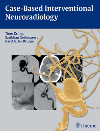 Case-Based Interventional Neuroradiology