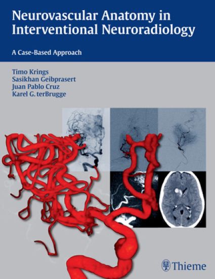 Neurovascular Anatomy in Interventional Neuroradiology