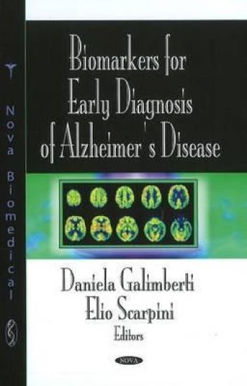 Biomarkers for Early Diagnosis of Alzheimer's Disease