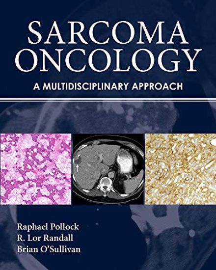 Sarcoma Oncology