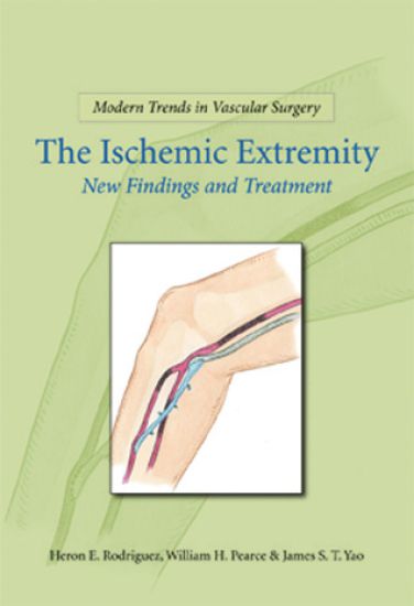 Modern Trends in Vascular Surgery: Ischemic Extremities