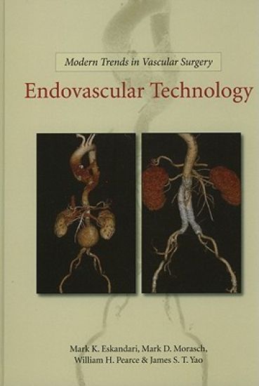 Modern Trends in Vascular Surgery: Endovascular Technology