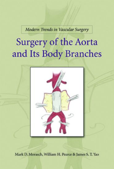 Modern Trends in Vascular Surgery: Surgery of the Aorta and its Body Branches