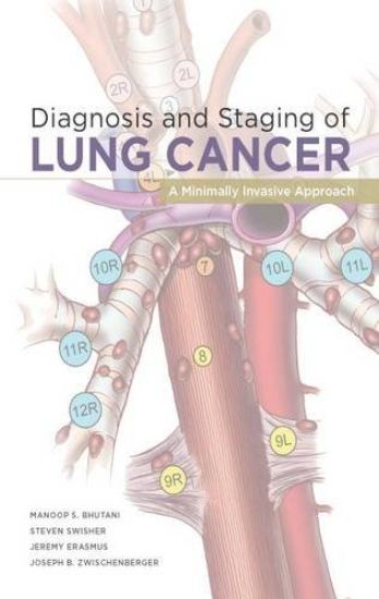 Diagnosis and Staging of Lung Cancer: A Minimally Invasive Approach