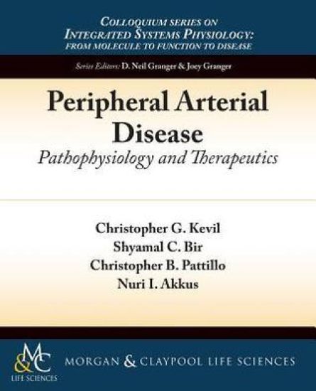 Peripheral Arterial Disease