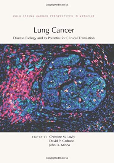 Lung Cancer: Disease Biology and Its Potential for Clinical Translation