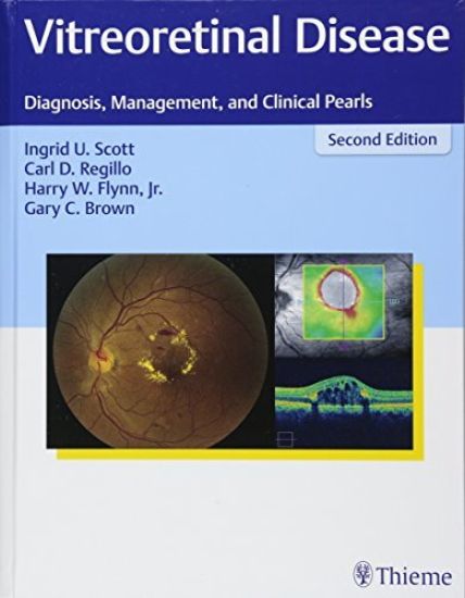 Vitreoretinal Disease