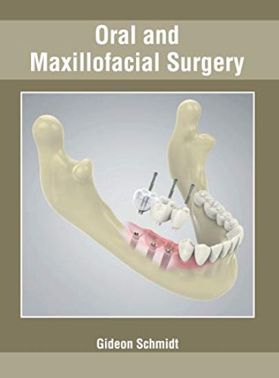 Oral and Maxillofacial Surgery