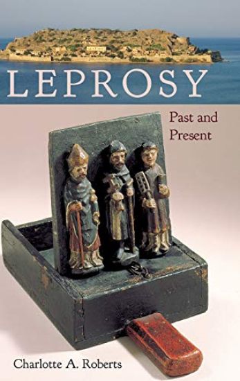 Leprosy
