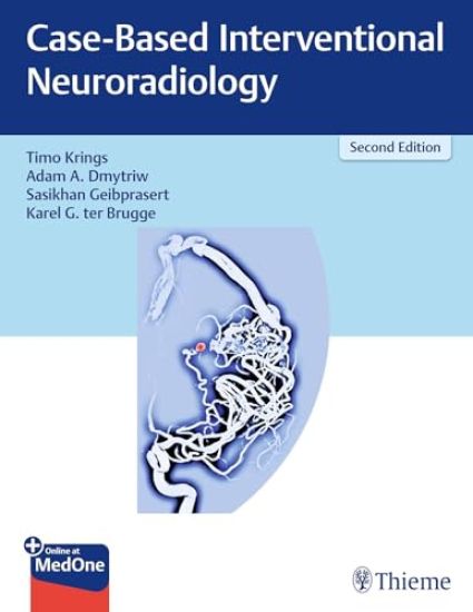 Case-Based Interventional Neuroradiology