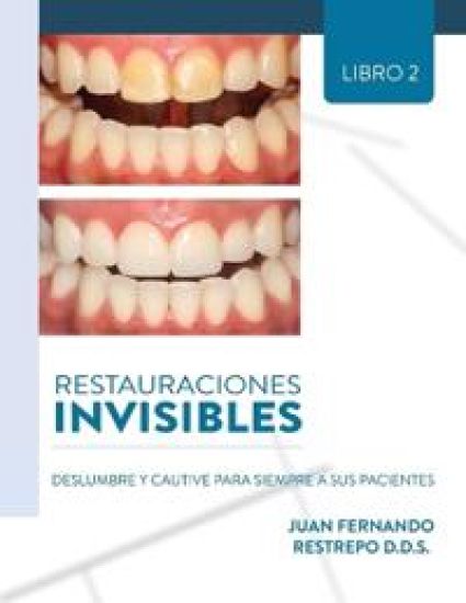 Restauraciones Invisibles