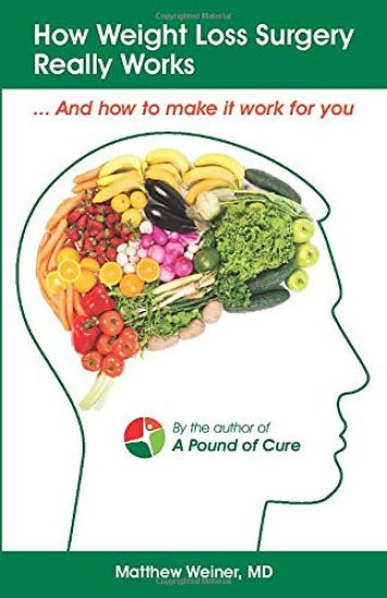 How Weight Loss Surgery Really Works