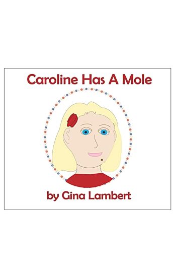 Caroline Has A Mole