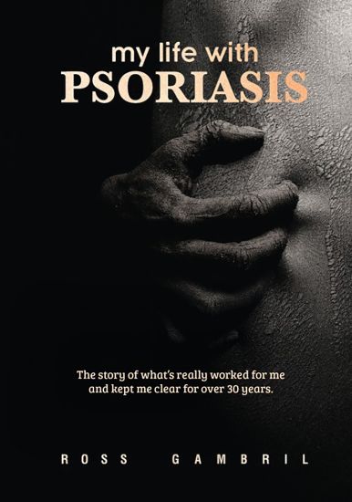 my life with PSORIASIS