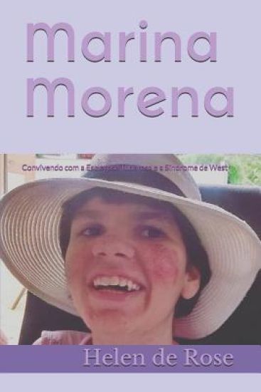 Marina Morena: Convivendo Com a Esclerose Tuberosa E a Síndrome de West