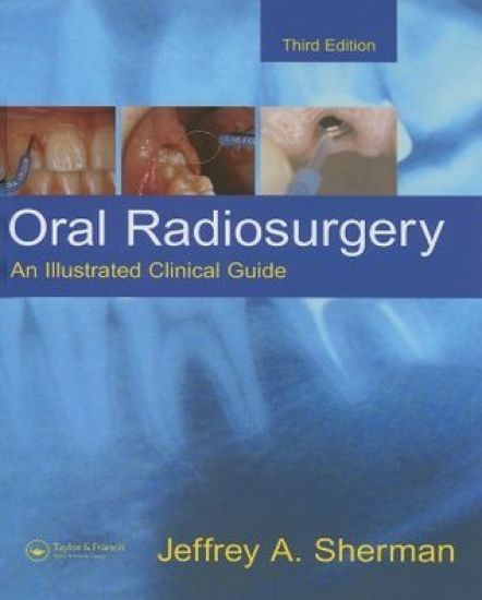 Oral Radiosurgery