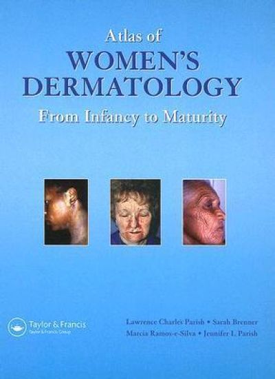 Atlas of Women's Dermatology