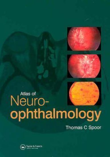 Atlas of Neuro-ophthalmology