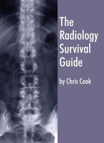 The Radiology Survival Guide