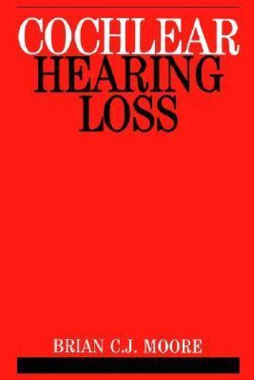 Cochlear Hearing Loss