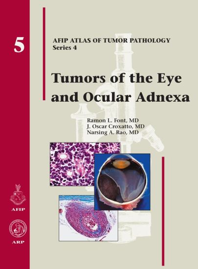 Tumors of the Eye and Ocular Adnexa