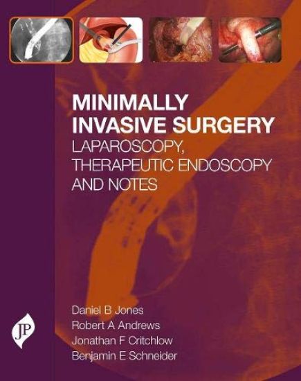 Minimally Invasive Surgery