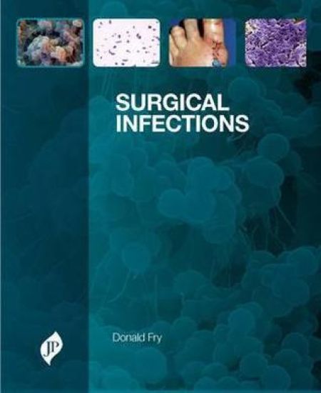 Surgical Infections