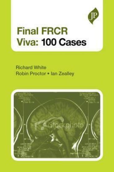 Final FRCR Part B Viva: 100 Cases and Revision Notes
