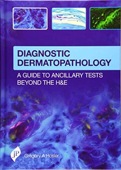 Diagnostic Dermatopathology: A Guide to Ancillary Tests Beyond the H&E