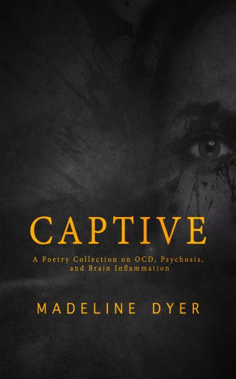 Captive