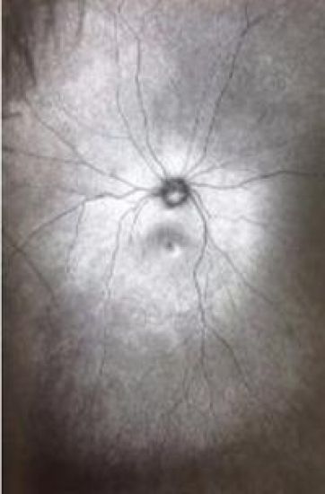 Supplement 3: The Invention and Conclusion of the Eye