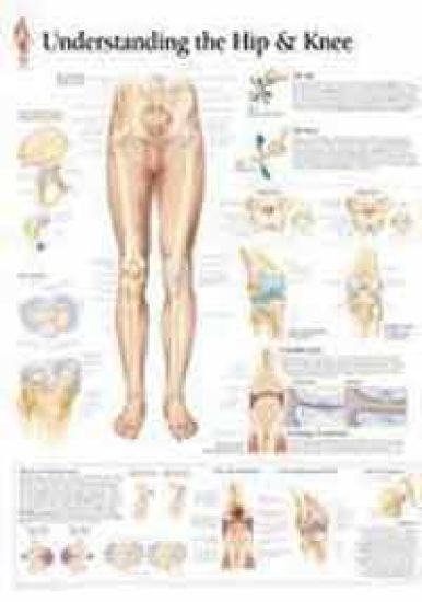 Understanding the Hip & Knee Laminated Poster