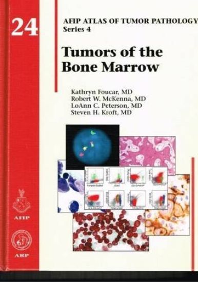 Tumors of the Bone Marrow