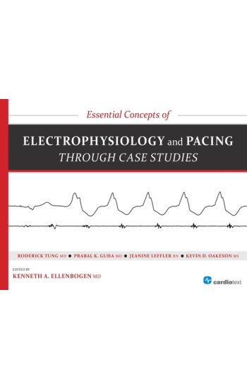 Essential Concepts of Electrophysiology and Pacing Through Case Studies