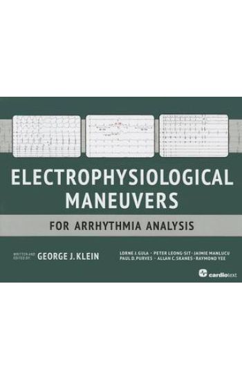 Electrophysiological Maneuvers for Arrhythmia Analysis