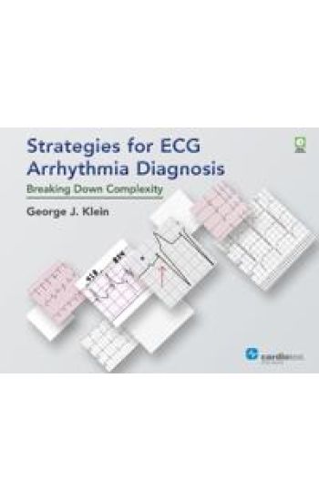 Strategies for ECG Arrhythmia Diagnosis