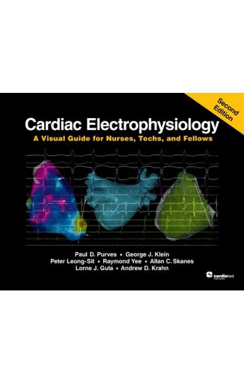 Cardiac Electrophysiology , Second Edition