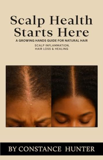 Scalp Health Starts Here