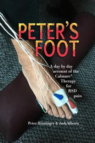 Peter's Foot: Calmare Treatment for RSD Pain Relief