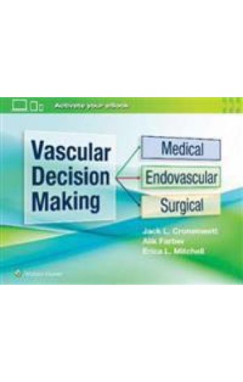 Vascular Decision Making